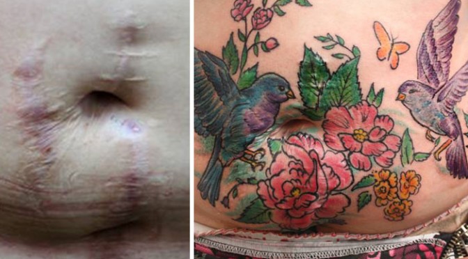 Brésil : Elle transforme les cicatrices de l’horreur en dessins d’espoir à l’aide de tatouages gratuits – aide pour surmonter les traumatismes des conjoints battus
